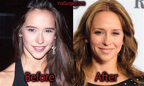 jennifer love hewitt breast reduction|Jennifer Love Hewitt’s boobs cut from The Client List